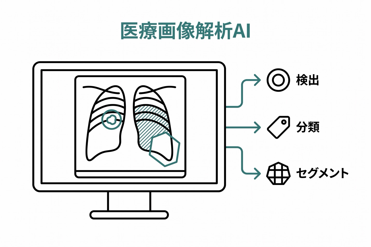 医療画像解析AI